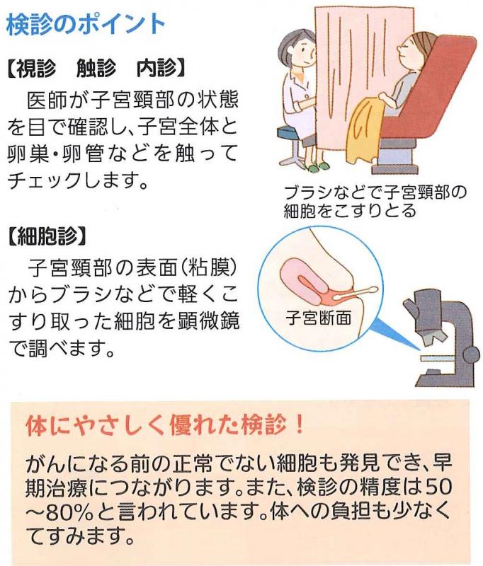 子宮がん検診の受診のポイント