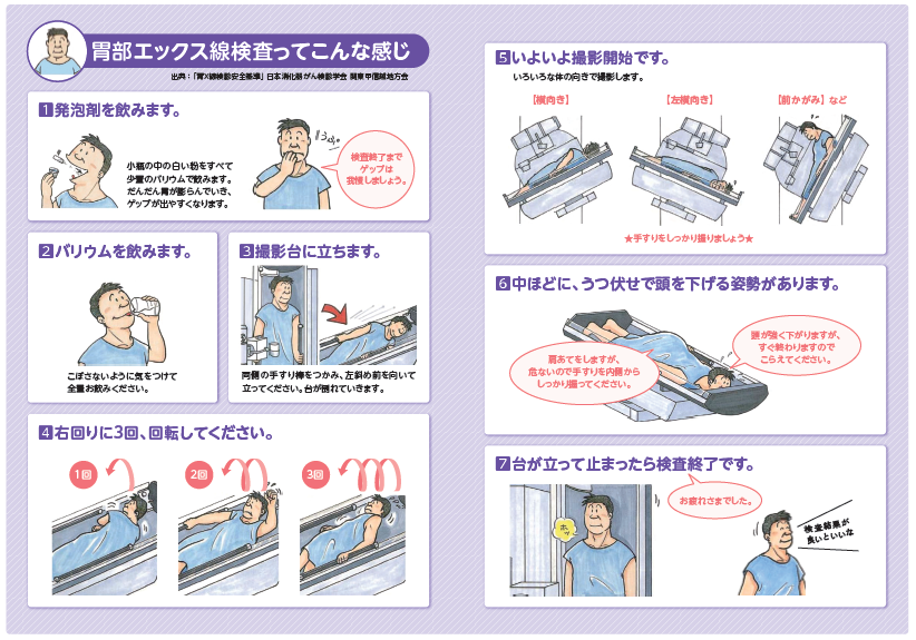 胃部X線検査ってこんな感じ